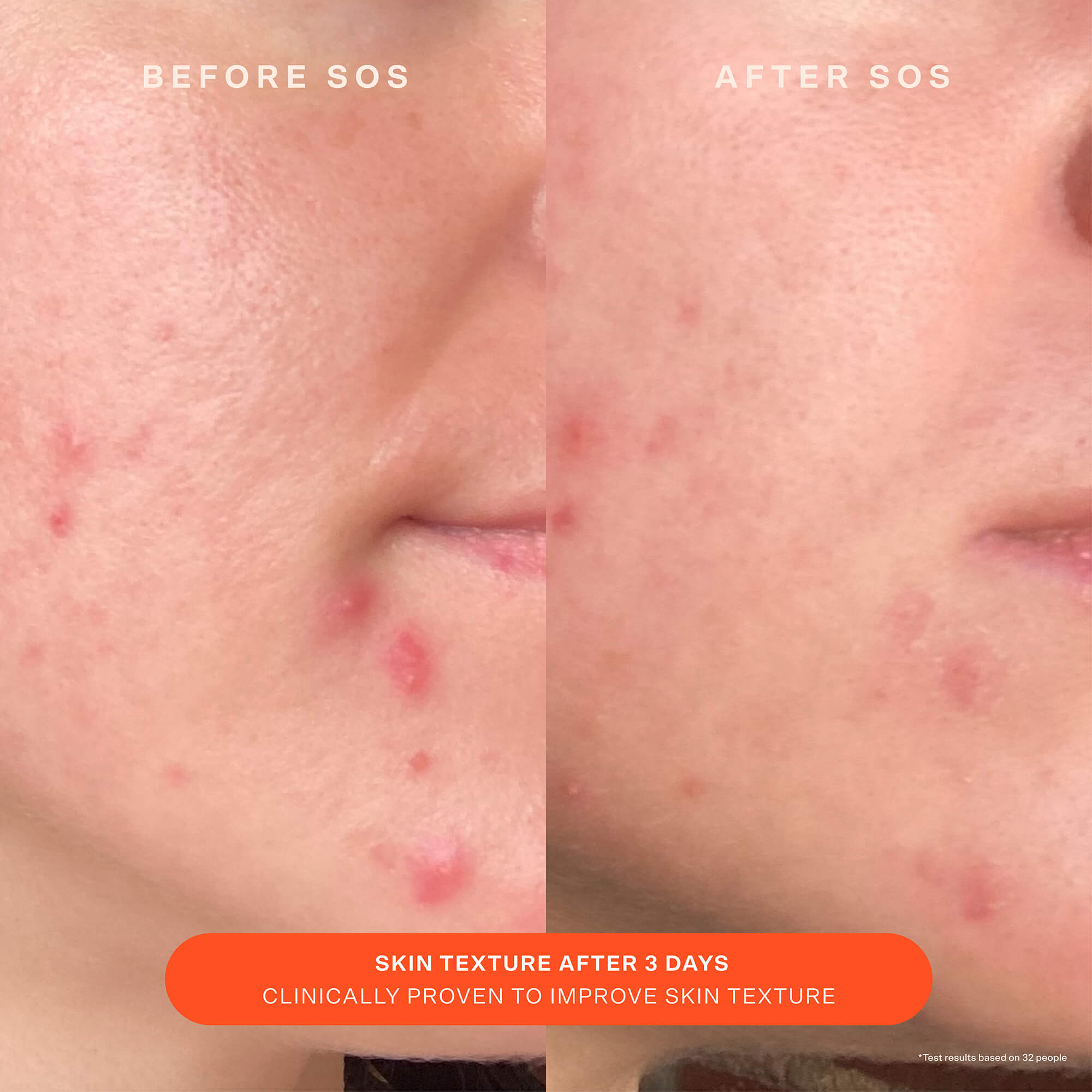 Travel SOS Recovery Cream 20ML