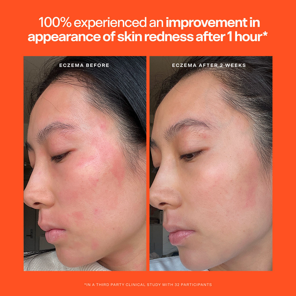 SOS Rescue Serum